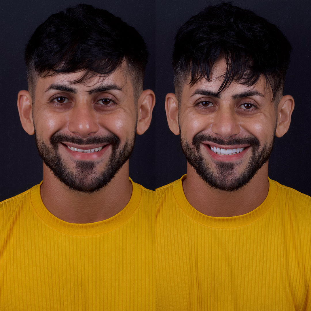 Antes e Depois novo-2